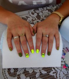 #summer #nails #hybrid #neon #yellow #cute #dark #green #iloveit Ideas For Nails, Nails Dark, Black French Tips, Diy Nail Designs, Ideas Nails, Dark Nails, Trendy Nail Design, Coffin Nails Designs, Gold Nails