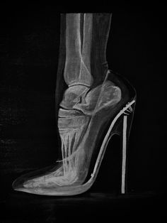 a black and white photo of a woman's foot with the heel exposed in