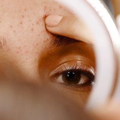 Surprising Acne Remedies We’re used to associating teenagers with acne but anyone can get them really. Worse yet, they always seem to come at an inconvenient time in your life. Luckily, there are... Best Face Cleanser, Treat Oily Skin, Face Map, Tea Tree Oil For Acne, Forehead Acne, Back Acne