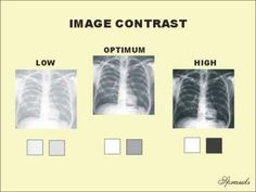 the chest is shown with three different images in front of it, and one has an image contrast