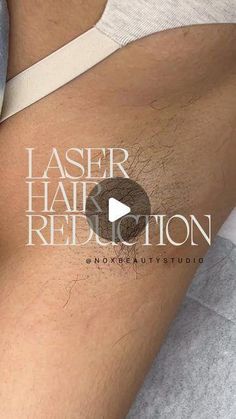 Laser Hair Removal Video, Laser Hair Removal Funny, Laser Hair Removal Marketing, Laser Hair Removal Aesthetic, Laser Hair Removal Results, Laser Hair Removal Facts, Chin Hair Removal, Underarm Waxing, Hair Laser