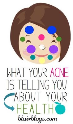 I had no idea that the location of facial acne is indicative of different health problems! This post helps to self-diagnose and cure acne. Acne Causes, Acne Facial, Acne Remedies, Back To Nature, Facial Care, Hair Skin, Beautiful Skin, Skin Health