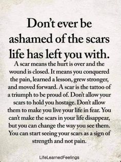 a poem that reads don't ever be shamed of the scars life has left you with