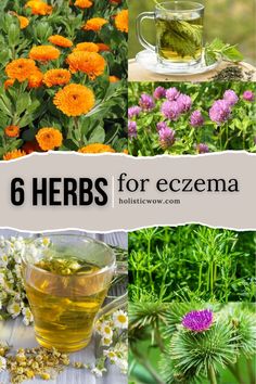 Excema Treatments Diy, Exema Treatments Natural, Calendula Tea, Plant Medicine, Herbal Recipes, Beauty Remedies, Herbal Blends, Chamomile Flowers, Healing Herbs