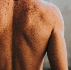 the back of a man with freckles on his body