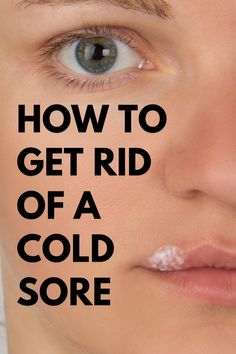 How to get rid of a cold sore fast Home Remedies For Allergies