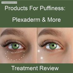 Before and after using treatments for under eye bags like Plexaderm altenatives. Top Treatments, Eye Creams, Dark Under Eye, Under Eye Bags, Natural Beauty Tips, Before And After Pictures, Puffy Eyes, Eye Bags