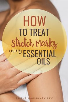 How to treat stretch marks with essential oils. Includes 3 recipes for stretch mark removal. Use one of these natural DIY stretch mark remedies to aid the appearance of stretch marks on your body. Typically, stretch marks appear on the abdomen, chest, and thigh areas, but can also show on the back or underarms. Essential oils are a beautiful, natural way to treat stretch marks. #essentialoils #stretchmarks #essentialoilhaven Strech Marks, Stretch Mark Remedies, Homemade Skincare, Essential Oils For Sleep, Stretch Mark Cream, Stretch Mark Removal, Sage Essential Oil, Using Essential Oils, Essential Oils For Skin