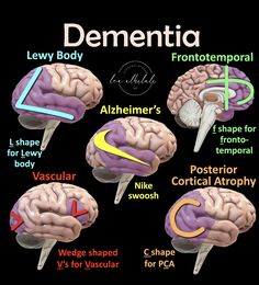 the different areas of the human brain