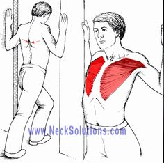 A Pain Between Shoulder Blades, Scapula Exercises, Lower Back Pain Remedies, Headache Relief Instant, Neck Injury, Pectoral Muscles, Natural Headache Remedies