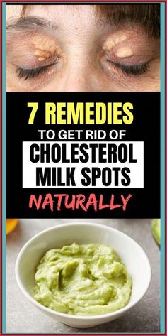 7 Remedies To Get Rid Of Cholester by donna Martin | This newsletter was created with Smore, an online tool for creating beautiful newsletters for educators, businesses and more White Bumps On Skin, Cholesterol Remedies, Best Detox, Skin Disorders, Nerve Pain, Winter Food, Health Remedies, Veggie Recipes