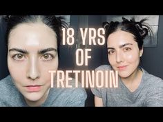 How To Remove Black Spots Under Eyes Gu Sha, Tretinoin Before And After, Home Facial Treatments, Retin A, Skin Hacks, Reflexology Points, Face Treatments, Face Routine, Anti Aging Secrets