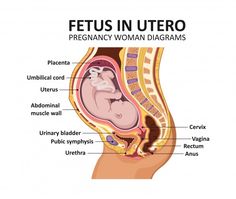 Fetus in utero. pregnancy women diagrams... | Premium Vector #Freepik #vector #baby #woman #medical #human Human Embryo, Female Anatomy, Abdominal Muscles, Pregnant Women, Vector Graphics, Premium Vector, Anatomy, Stock Illustration, Medical