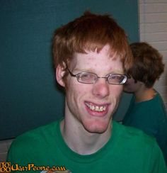 a young man with red hair and glasses is making a funny face at the camera