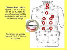 Chinese cupping point from DR, Tamer's Cupping Therapy encyclopedia | Cupping therapy, Cupping ... Holistic Tips, Polarity Therapy, Football Referee, Ayurvedic Massage, Call Me Now