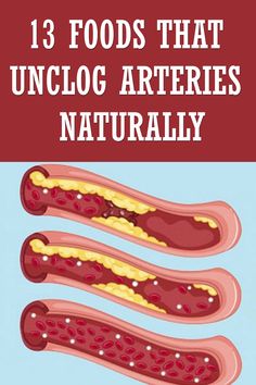 Foods That Unclog Arteries Naturally Clean Arteries, Unclog Arteries, Beach Hacks Tips And Tricks, Heart Healthy Diet, Healthy Advice, Beach Hacks, Healthy Smoothie