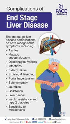 End Stage Liver Disease (ESLD) Complications Liver Damage, Liver Failure, Disease Symptoms, The Liver, Liver Health, Medical Illustration, Hyderabad, Disease, Medical Illustrations