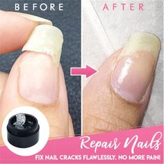 Nail Nail Strengthener Fix Nail Instant Cracked Nail Repair Gel Cracks Nail Damaged Nails Repair, Repair Broken Nail, Cracked Nails, White Gel Nails, Nail Coat, Broken Nails, Green Nail Polish, Nail Repair, Gel Nail Colors