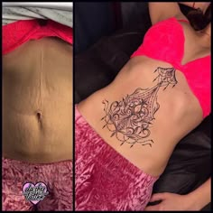 a woman's stomach before and after her tattoo removal in las vegas, nv