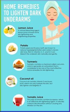 Underarms tips #underarms #underarmhairremoval #underarmsmellremedies #healthy #fresh #clean Remedies For Dark Underarms, Rid Of Dark Underarms, For Dark Underarms, Remedies For Glowing Skin, Dark Armpits, Home Remedies For Skin, Natural Skin Care Remedies, Dark Underarms, Beauty Tips For Glowing Skin