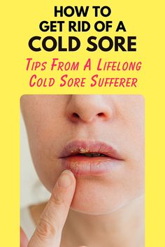 How to get rid of a cold sore fast Cold Sore Remedy Overnight, Fever Blister