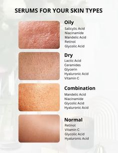 Acne Types, Serum For Oily Skin, Normal Skin Care, Oily Skin Face, Beauty Treatments Skin Care, Mekap Mata, Skin Care Basics, Face Skin Care Routine, Skin Advice