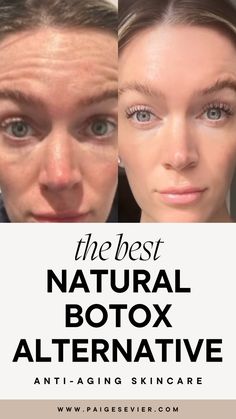 Looking for the best botox alternative products & natural skincare for women over 40? Learn about my favorite waterless skincare products & anti aging skincare products for women over 30 here! Add these anti-inflammatory skincare products to your skincare routine for wrinkles & see why so many women love this natural botox alternative! Best Natural Anti Aging Skin Care, Natural Botox Alternative, Skin Care After 40 For Women, Skincare 40s For Women, Natural Botox For Face, Botox Alternative Products, Waterless Skincare, Skincare Specialist, Regular Skin Care Routine