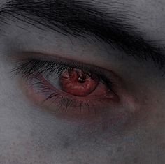 the eye of a person with red eyes