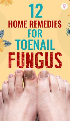 Managing infected toenails is easier with simple ingredients available in your home. ​#toenailfungus #homeremedies Nail Remedies, Toenail Fungus Remedies, Nail Fungus Remedy, Fungal Nail, Ingrown Toe Nail, Healthy Liver, Toenail Fungus, Nail Fungus, Nail Health