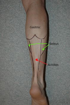 an image of a person's legs with different lines on them