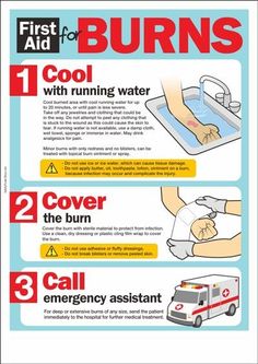 Burn First Aid, First Aid Poster, First Aid For Burns, First Aid For Kids, First Aid Cpr, First Aid Tips, Safety Poster, Emergency First Aid, Emergency Preparedness Kit