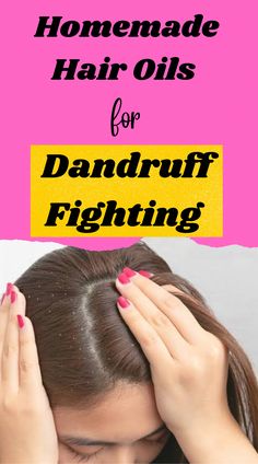 Do you suffer from dandruff? If so, you know how embarrassing and itchy it can be. Dandruff is caused by a yeast-like fungus that grows on the scalp and can Homemade Hair Spray, Hair Thickening Oil, Homemade Hair Oil, Natural Dandruff Remedy, Hair Mask For Dandruff, Diy Hair Oil, Home Remedies For Dandruff, Best Hair Growth Oil, Oils For Dandruff