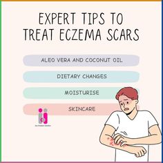 Struggling with eczema scars? Discover expert tips to treat them effectively and restore your skin's natural beauty. Buy Herbal products to manage eczema problems:[https://tinyurl.com/5fr2affd] #EczemaRelief #SkincareTips #HealthySkin #NaturalHealing #skincareroutine #likeforlikes #followforfollowback #india #herbalproducts #ayurvedicdoctor #stayfitstayhealthy Ayurvedic Doctor, Herbal Products, Problem And Solution, Natural Healing, Stay Fit, Natural Skin, How To Stay Healthy, Skin Care Tips, Natural Remedies