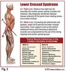 Thoracolumbar Fascia, Lumbar Lordosis, Hip Flexor Pain, K Tape, Muscle Imbalance