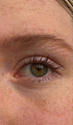 a woman's green eyes with freckles on her forehead and eyebrows are visible