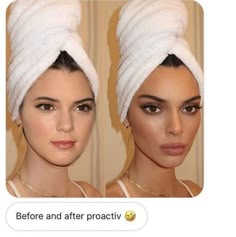 Kendall Jenner Eyes, Estilo Gossip Girl, Stile Kendall Jenner, Botox Before And After, Plastic Surgery Photos, Celebs Without Makeup, Eyebrow Lift