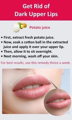 Upper Lips, Lip Care Tips, Potato Juice, Fresh Potato, Natural Skin Care Remedies, Routine Skin