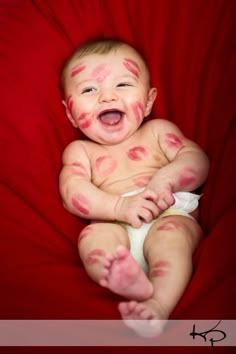 a baby with red spots all over it's body sitting on a red blanket