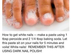 How to whiten stained nails. Stained Nails, Skin Care Routine For 20s, Catholic Education, Pinterest Nails, Age Gracefully, Pinterest Diy, Shellac Nails, Foot Care