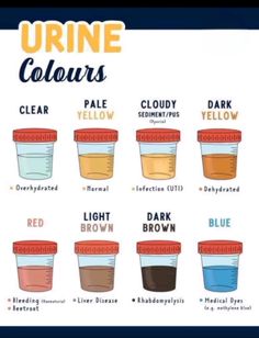 the different types of urine colours in each jar are shown on this page, and there is