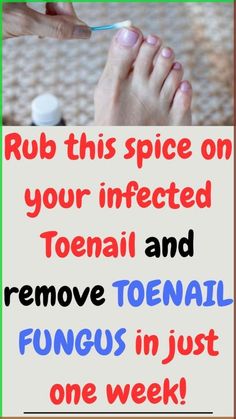 Toenail fungus is destructive to your nails and more common than you think! After trying several over the counter remedies that failed, I turned to natural remedies and finally got rid of my toe nail fungus. | summer nail 2023 | nail summer idea | nail gel 2023 | fungus treatment toenails | nail fungus cure | nail fungal infection remedies | fungal infection | nail fungus soak #summernailsideas2023 #killsnail #treatmentfungus #nailfungus #toenailfungus #fungus #fungustretment #fungustoenail ` Summer Nail 2023, Fungal Infection Remedies, Infected Toenail, Idea Nail