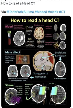 an image of the head and brain with words describing how it is made to read