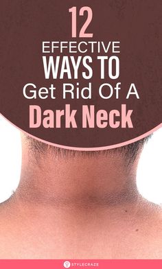 Dark Skin Around Neck, Dark Neck Remedies, Get Rid Of Dark Neck, Dark Patches On Skin, Dark Neck, Natural Sleep Remedies, Natural Cough Remedies, Sleep Schedule