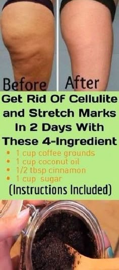 Trening Fitness, Coffee Scrub, Health And Beauty Tips, Natural Medicine, Natural Living, Health Remedies, Herbal Remedies, Easy Workouts, Healthy Tips