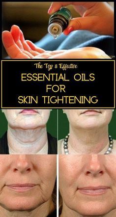 Get Rid Of Saggy Skin, Skin Tightening Essential Oil, Diy Skin Tightening, For Skin Tightening, Top Essential Oils, Essential Oils For Skin, Saggy Skin, Sagging Skin, Diy Skin