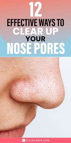 Enlarged nose pores can look unsightly. They can disrupt your overall look and may grow in size over time. However, here’s the thing – you can cleanse, unclog, and shrink them with a little upkeep and the correct home remedies.