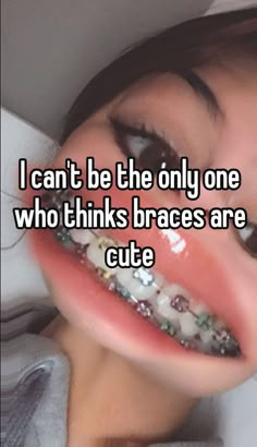 a woman with braces on her teeth and the words i can't be the only one who thinks braces are cute