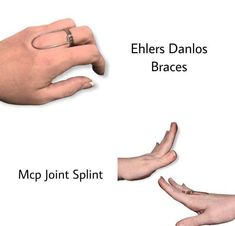 Arthritis EDS finger splint adjustable for all types of deviation, comfortable splint ring one piece, lateral deviation, mallet finger Comes in a FREE GIFT BOX Perfect for Mother's Day Gift For Mom Makes a Wonderful Gift for your Girlfriend, Wife, Mom or Simply an Excellent Addition to Your Jewelry Collection. Please make sure to include the correct address during checkout. Buyer Note :- The Buyer is Fully Responsible For Any Charges , Import, Custom Duties and Taxes in Buyer Country . World Wid Mallet Finger, Finger Splint, Gifts For Your Girlfriend, Rings Statement, Free Gift, Halloween Shopping, Statement Rings, Free Gifts, Mother's Day Gifts