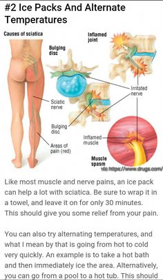 the diagram shows how to use ice packs and allergies