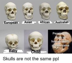 skulls are not the same ppl